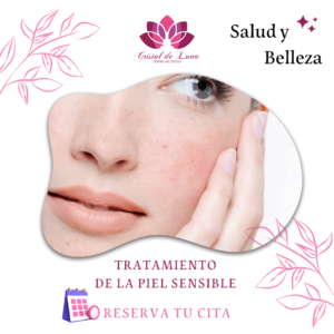 TRATAMIENTO DE LA PIEL SENSIBLE
